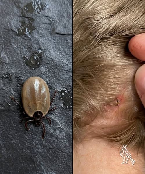 How to stay calm when you find unwanted “guests” in your child’s hair.