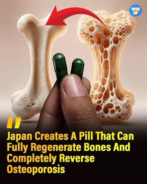 🦴A Daily Pill That Could Rebuild Bone? New Research Offers Hope for Osteoporosis