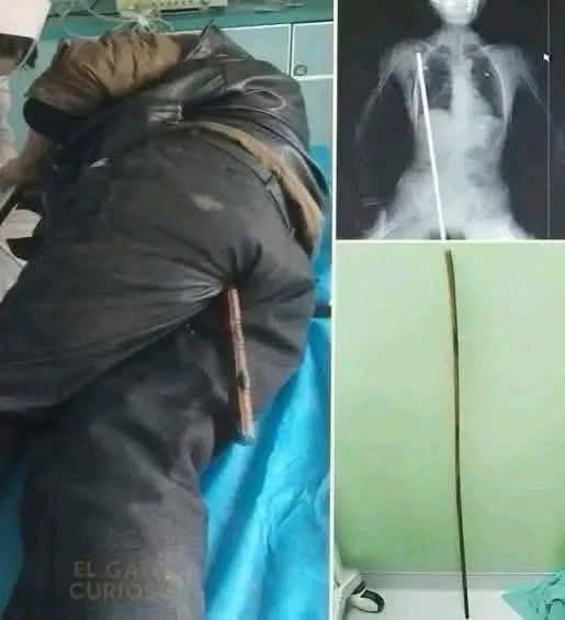 Young man hospitalized after being arrested….