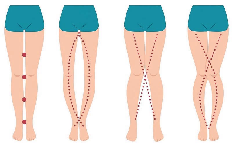 The Subtle Messages Hidden in a Woman’s Legs