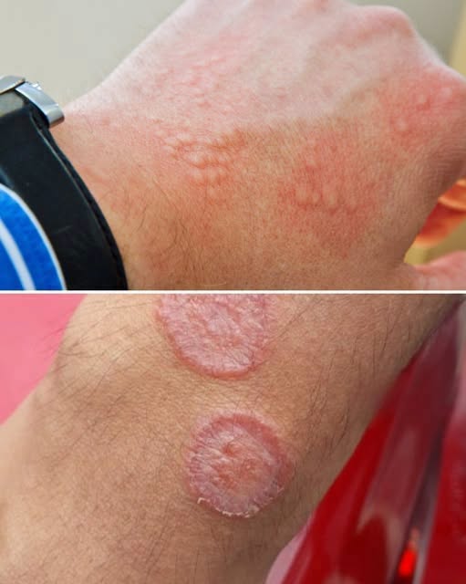 The Deadly Warning Signs Your Skin Is Sending You That You Should Never Ignore