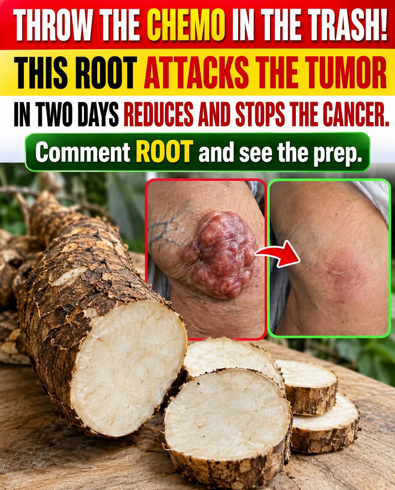 The Root Said to Attack Tumors and Stop Cancer in Two Days