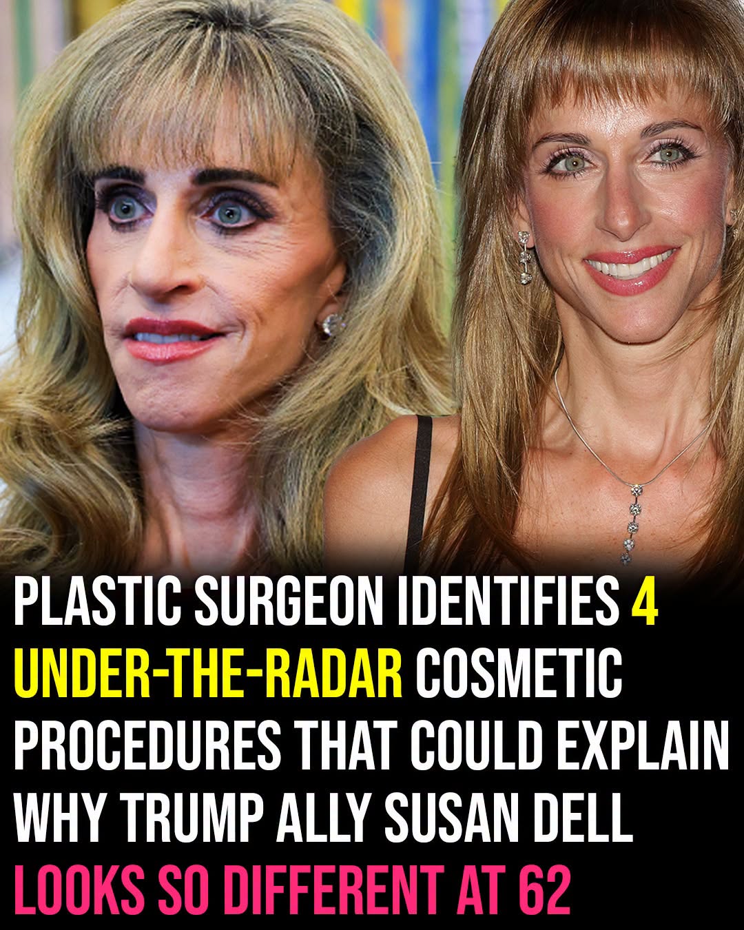 Susan Dell steals the spotlight beside Trump – her dramatically different look has surgeons weighing in